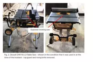 Thumbs Up For Docs Who Saved Teen’s Digit