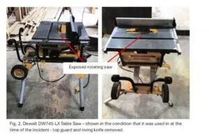 Thumbs Up For Docs Who Saved Teen's Digit